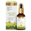 Vaadiherbals Anti-Acne Serum With Glycolic & 2% Salicylic Acid - 30 ml