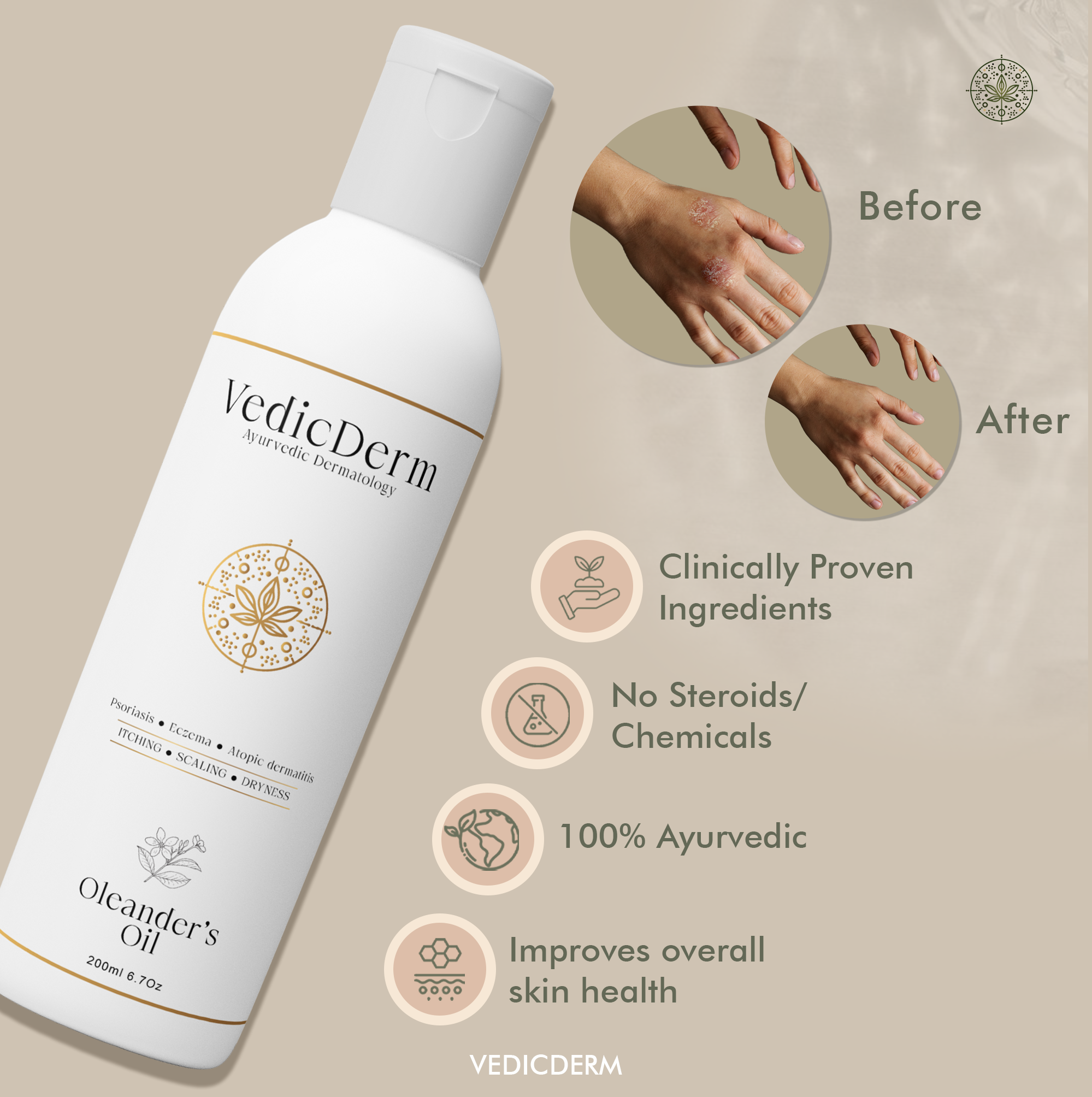 Vedicderm Oleander's Oil for Psoriasis, Eczema, Atopic Dermatitis - 200 Ml